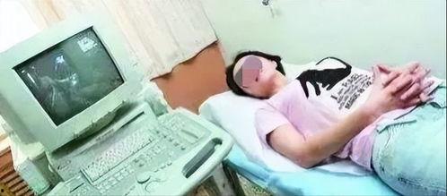 男大夫做阴超的视频,男性医生进行阴超检查的实践操作解析