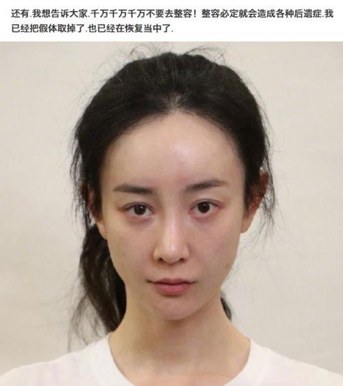 明星鼻头多大,揭秘明星鼻型与颜值的秘密